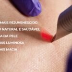 foto de rejuvenescimento